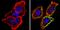 Thrombomodulin antibody, MA5-11454, Invitrogen Antibodies, Immunofluorescence image 