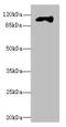 Membrane Bound Transcription Factor Peptidase, Site 1 antibody, LS-C676026, Lifespan Biosciences, Western Blot image 