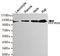 Protein Phosphatase 1 Regulatory Subunit 18 antibody, M09343, Boster Biological Technology, Western Blot image 