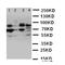 Neuregulin 2 antibody, orb76151, Biorbyt, Western Blot image 