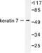 Keratin 7 antibody, LS-C176100, Lifespan Biosciences, Western Blot image 