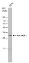 Major Histocompatibility Complex, Class II, DQ Alpha 2 antibody, PA5-78002, Invitrogen Antibodies, Western Blot image 