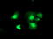Deoxythymidylate Kinase antibody, M12209, Boster Biological Technology, Immunofluorescence image 
