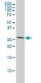 Acidic Nuclear Phosphoprotein 32 Family Member A antibody, H00008125-M01, Novus Biologicals, Western Blot image 