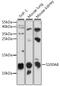 S100 Calcium Binding Protein A8 antibody, 15-986, ProSci, Western Blot image 