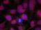 ATM Serine/Threonine Kinase antibody, 79-558, ProSci, Immunofluorescence image 