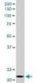 NADH:Ubiquinone Oxidoreductase Core Subunit V2 antibody, H00004729-M03, Novus Biologicals, Western Blot image 