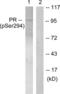 Progesterone Receptor antibody, LS-C199493, Lifespan Biosciences, Western Blot image 