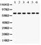 Protein Kinase C Delta antibody, LS-C357611, Lifespan Biosciences, Western Blot image 