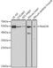 UV excision repair protein RAD23 homolog A antibody, GTX33455, GeneTex, Western Blot image 