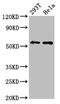 Erythropoietin Receptor antibody, CSB-PA007744LA01HU, Cusabio, Western Blot image 