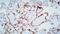 Fms Related Tyrosine Kinase 4 antibody, GTX01880, GeneTex, Immunohistochemistry paraffin image 