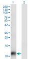 Small Nuclear RNA Activating Complex Polypeptide 5 antibody, MA5-21004, Invitrogen Antibodies, Western Blot image 