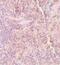 Sequestosome 1 antibody, PA5-20839, Invitrogen Antibodies, Immunohistochemistry paraffin image 