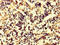 IL-17 antibody, abx313226, Abbexa, Immunohistochemistry paraffin image 