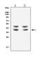 Absent In Melanoma 2 antibody, GTX00830, GeneTex, Western Blot image 