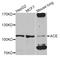 Angiotensin I Converting Enzyme antibody, abx007261, Abbexa, Western Blot image 