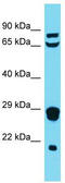 Mitochondrial Ribosomal Protein L18 antibody, TA337436, Origene, Western Blot image 