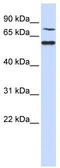 POC1 Centriolar Protein B antibody, TA330950, Origene, Western Blot image 