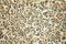 Dual Specificity Tyrosine Phosphorylation Regulated Kinase 4 antibody, 12890-2-AP, Proteintech Group, Immunohistochemistry paraffin image 