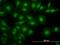Nuclear Receptor Subfamily 4 Group A Member 2 antibody, H00004929-M08, Novus Biologicals, Immunofluorescence image 
