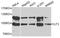 Interleukin Enhancer Binding Factor 3 antibody, orb135749, Biorbyt, Western Blot image 