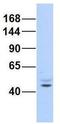 AF4/FMR2 Family Member 2 antibody, GTX44623, GeneTex, Western Blot image 