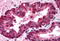 Interferon Regulatory Factor 3 antibody, MBS240831, MyBioSource, Immunohistochemistry paraffin image 