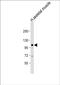 Growth Arrest Specific 2 Like 2 antibody, PA5-48197, Invitrogen Antibodies, Western Blot image 