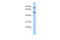 Pogo Transposable Element Derived With KRAB Domain antibody, 25-491, ProSci, Western Blot image 