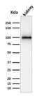 Membrane Metalloendopeptidase antibody, GTX18040, GeneTex, Western Blot image 