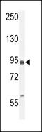 EF-Hand Domain Family Member B antibody, LS-C167645, Lifespan Biosciences, Western Blot image 