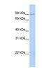 Transmembrane And Coiled-Coil Domain Family 2 antibody, NBP1-91562, Novus Biologicals, Western Blot image 