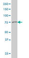 ADF antibody, LS-B5419, Lifespan Biosciences, Western Blot image 