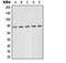 Protein Kinase C Delta antibody, LS-C352714, Lifespan Biosciences, Western Blot image 