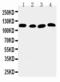 ATPase Sarcoplasmic/Endoplasmic Reticulum Ca2+ Transporting 2 antibody, LS-C312872, Lifespan Biosciences, Western Blot image 