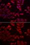 Selenophosphate Synthetase 1 antibody, GTX55789, GeneTex, Immunocytochemistry image 