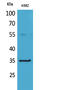 Fc Fragment Of IgG Receptor IIa antibody, STJ96610, St John