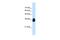 Reticulophagy Regulator 1 antibody, PA5-42647, Invitrogen Antibodies, Western Blot image 