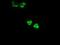 Glucokinase antibody, NBP1-47778, Novus Biologicals, Immunofluorescence image 