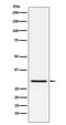 P58753 antibody, M00950-1, Boster Biological Technology, Western Blot image 