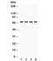 ETS Variant 4 antibody, R32103, NSJ Bioreagents, Western Blot image 