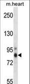 Protein Kinase C Eta antibody, LS-C164551, Lifespan Biosciences, Western Blot image 