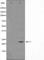 BCL2 Associated Agonist Of Cell Death antibody, abx011755, Abbexa, Western Blot image 