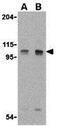 Lysine Demethylase 1A antibody, GTX31730, GeneTex, Western Blot image 