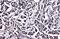 GST3 antibody, GTX112953, GeneTex, Immunohistochemistry paraffin image 