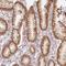Activin A Receptor Type 1B antibody, NBP2-39003, Novus Biologicals, Immunohistochemistry frozen image 