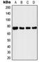 Interleukin 1 Receptor Associated Kinase 1 antibody, MBS822180, MyBioSource, Western Blot image 