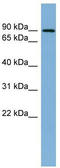 TANK Binding Kinase 1 antibody, TA334469, Origene, Western Blot image 