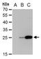 Dengue virus antibody, GTX103349, GeneTex, Western Blot image 